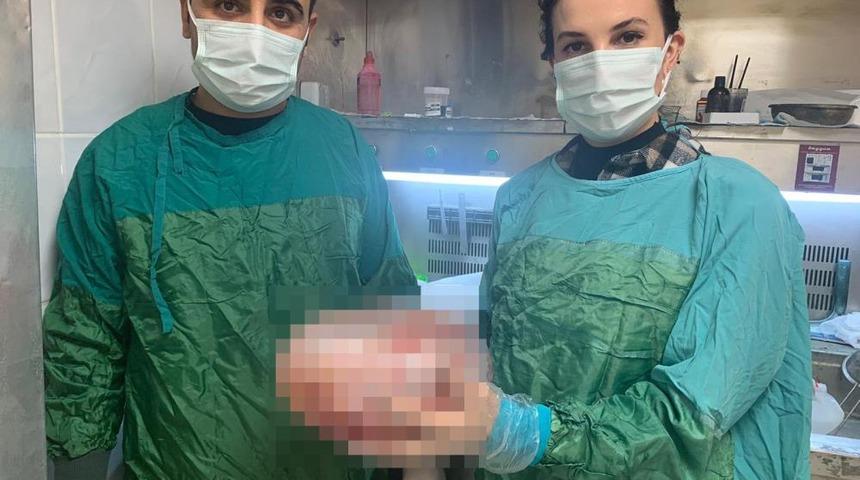 Karın ağrısı şikayeti ile hastaneye gitti, karnından 5 kiloluk kitle çıktı