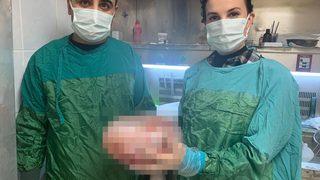 Karın ağrısı şikayeti ile hastaneye gitti, karnından 5 kiloluk kitle çıktı