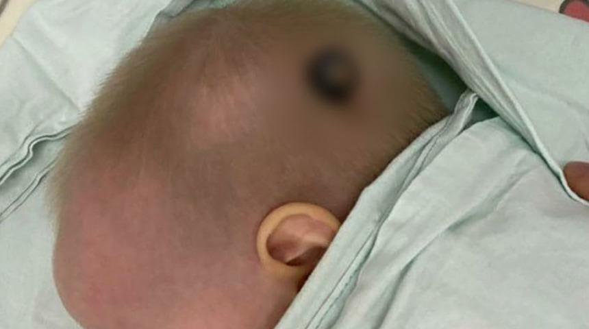 Oyuncak arabanın tekerleği kafatasını deldi, milimle kurtuldu!