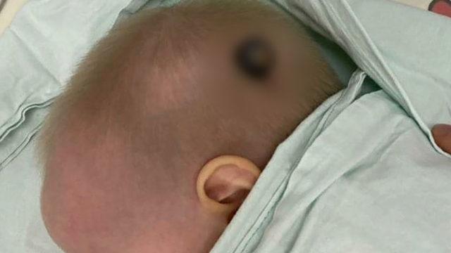 Oyuncak arabanın tekerleği kafatasını deldi, milimle kurtuldu!