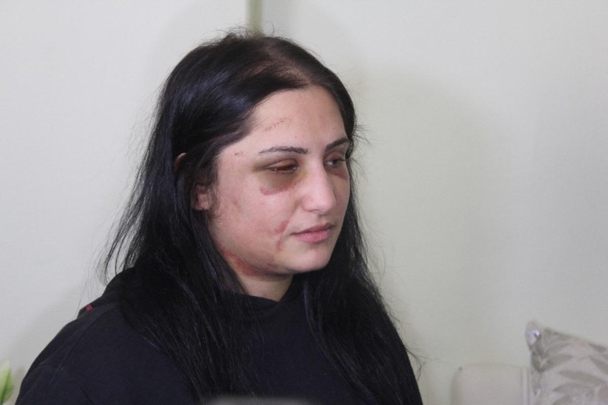 Eski eşini darp eden zanlının iddianamesi tamamlandı