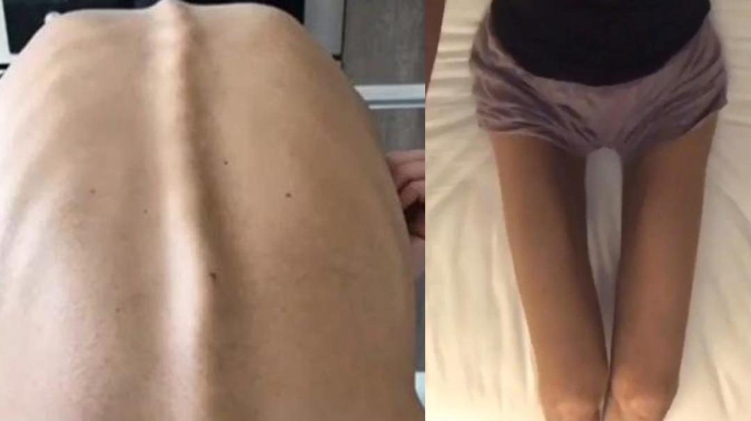 Sevilen şarkıcı Ayşe Akın'dan anoreksiya itirafı 