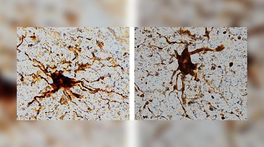 İnsan beyninde öldükten sonra harekete geçiyor: Zombi genler!