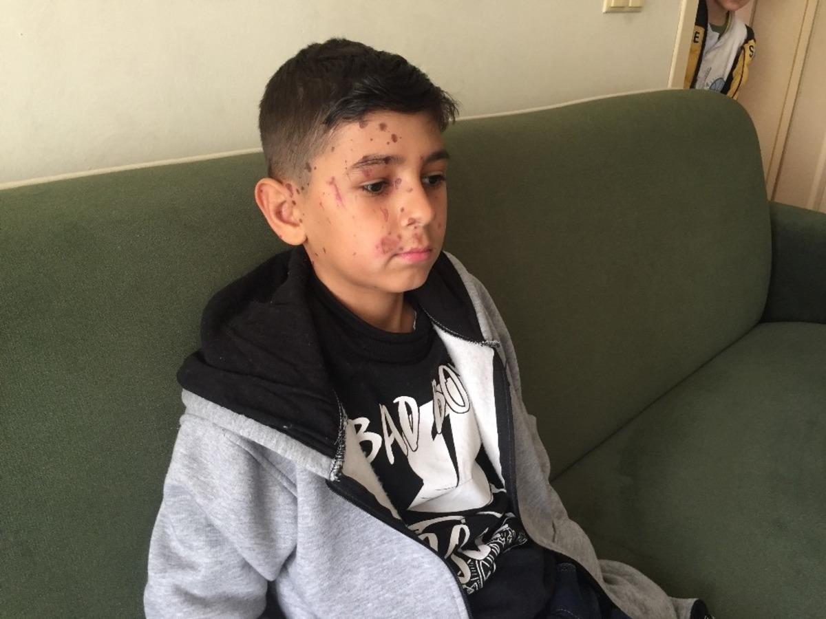 Arkadaşının attığı temizlik maddesi k&ouml;r ediyordu