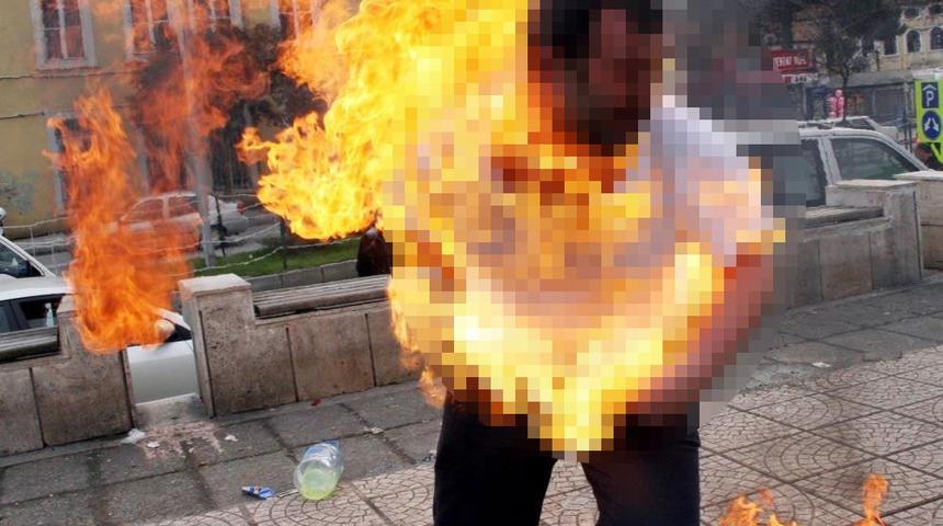 Dolandırıldığını söyleyip kendini ateşe vermişti! 'Dehşet' fotoğraftaki adam konuştu