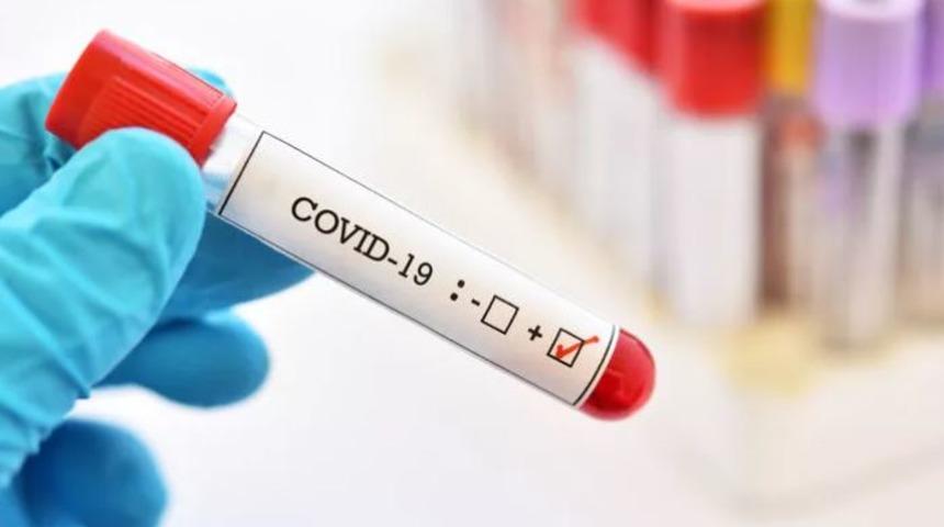 Mutant virüs Türkiye genelinde yüzde 80'e ulaştı, il il tam kapanma gündemde 