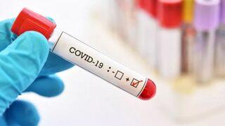 Mutant virüs Türkiye genelinde yüzde 80'e ulaştı, il il tam kapanma gündemde 