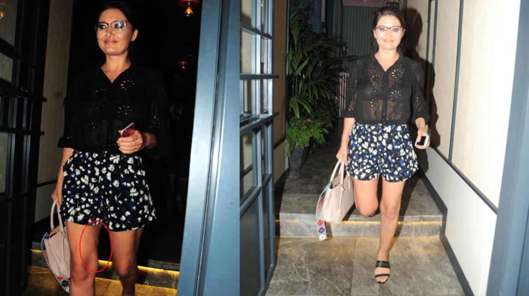 Nurg&uuml;l Yeşil&ccedil;ay'ın mini şortu sel&uuml;litlerini ortaya &ccedil;ıkardı