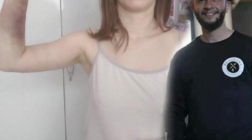 Korkunç olay! Genç kızı beyzbol sopasıyla darp etti