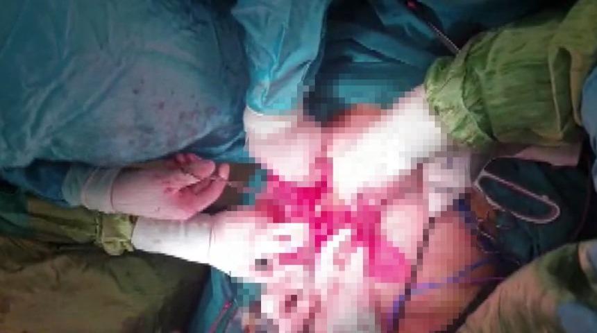 Hamile olduğunu düşündü, karnında 8 kiloluk kitle tespit edildi!