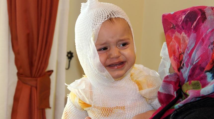 Erzincan’da üzerine kaynar süt dökülen çocuk hastanelik oldu