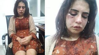 Eski sevgilisi tarafından darp edilen genç kızın 'Ölmek istemiyorum' paylaşımı