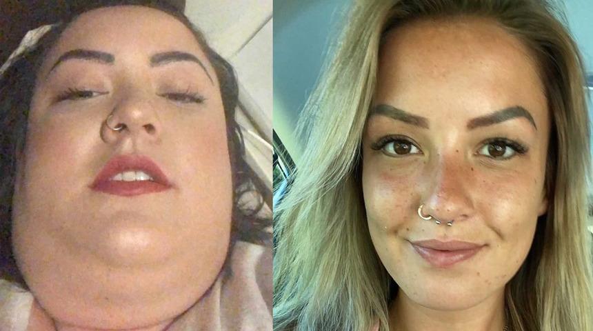 Fast food için kilometrelerce yol gidiyordu! Obez kadın şimdi tanınmaz halde: ''Reddeden erkekler şimdi kapımda''