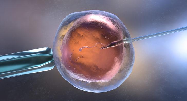 Tüp bebek yönteminde sperm ve embriyo kalitesi de sonucu etkiliyor!