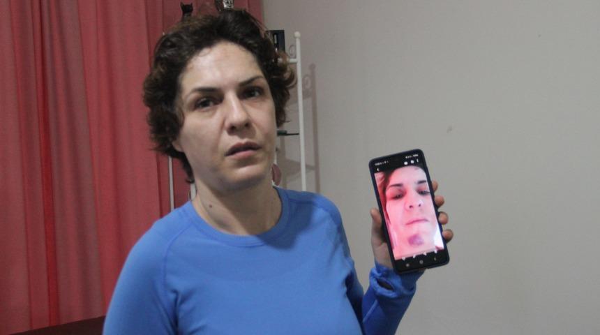 Dini nikahla birlikte yaşadığı adam kabusu oldu: Beni tanımasın diye sa&ccedil;ımı kazıttım