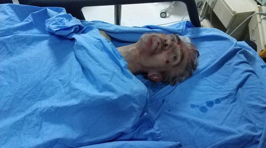 Samsun&rsquo;daki silahlı saldırıda &ouml;l&uuml; sayısı 2&rsquo;ye &ccedil;ıktı