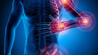 Kayropraktik tedavi nedir?
