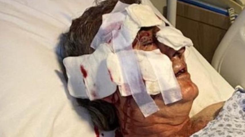 Dehşeti yaşadı! Kafesten kaçan maymun otel görevlisini tanınmaz hale getirdi