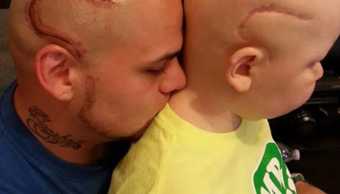 Kanserli oğlunun ameliyat izini dövme olarak yaptıran babanın hikayesi duygulandırdı