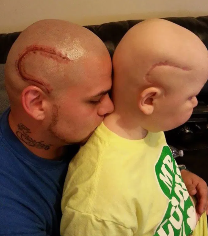 Kanserli oğlunun ameliyat izini dövme olarak yaptıran babanın hikayesi duygulandırdı