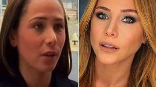 Burçin Terzioğlu'dan estetik itirafı! 'Bir ay basket topu gibi gezdim'