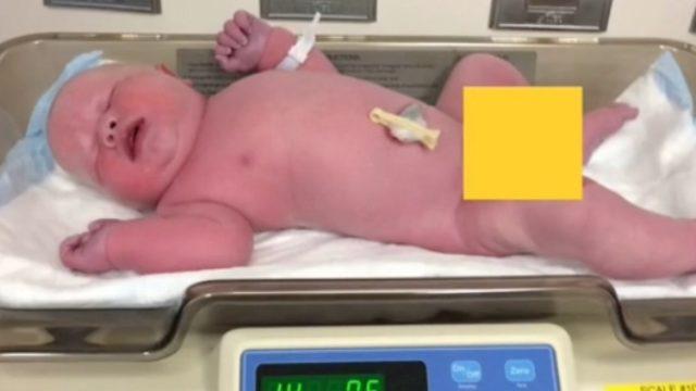 Yeni doğdu ama dokuz aylık bebek kıyafeti giyiyor! Kilosu ve uzunluğu şaşkına çevirdi