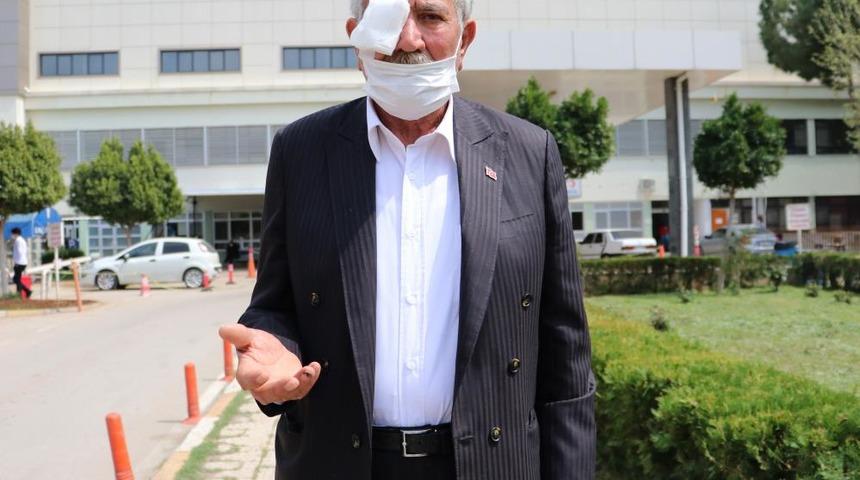 Akılalmaz olay! 50 kuruşluk tuvalet parası için gözünden oldu