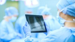 Korona hastasına dünyanın ilk canlı akciğer nakli!