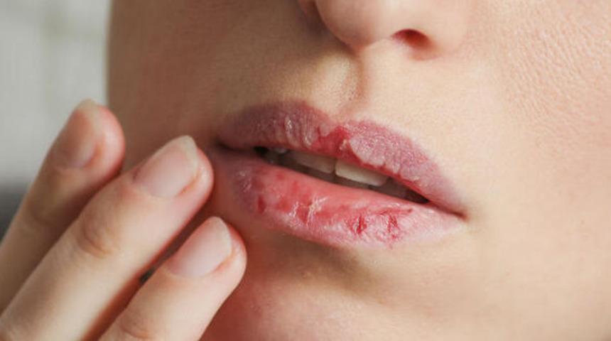 Dudak yemek orucu bozar mı? Diş eti kanaması abdest bozar mı?