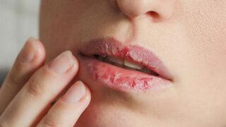 Dudak yemek orucu bozar mı? Diş eti kanaması abdest bozar mı?