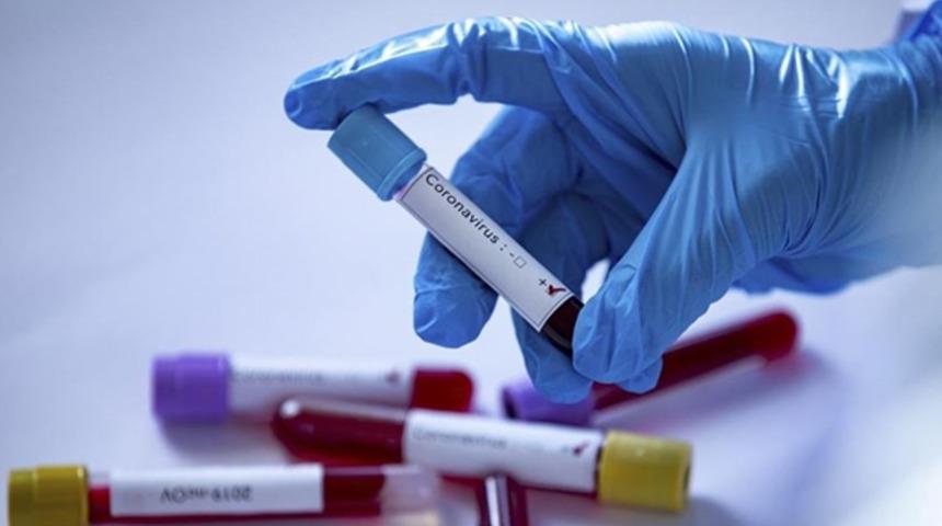 Fenerbahçe Opet'te bir kişinin Kovid-19 testi pozitif