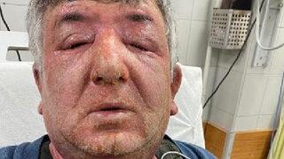 Taksisine aldığı müşteriden şüphelendi! Eline yüzüne sürdüğü dezenfektan hastanelik etti