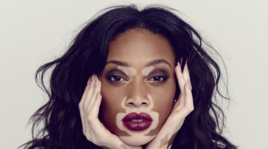 Güzellik standartlarını alt üst eden modern dünyanın ilham veren modelleri