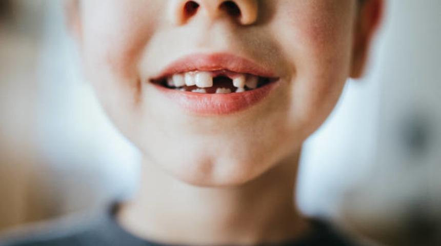 Çocuklarda dişlere acil müdahale edilmeli