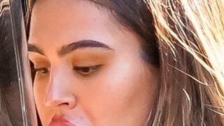 Amelia Gray Hamlin'in dudaklarına ne oldu?