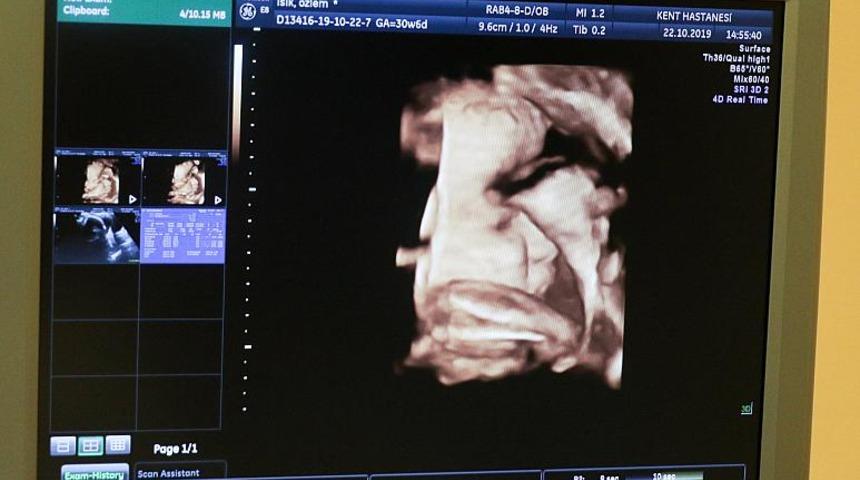 Hamileyken ikinci kez hamile kaldı, 2 çocuğu oldu!