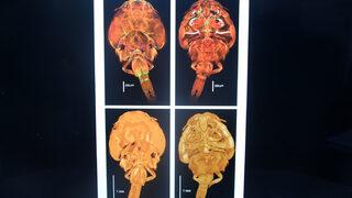 Yeni keşfedilen öldürücü parazite 'Adana' ismini verdiler