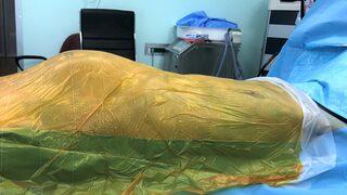 Karnındaki dev anevrizma, doktorlarını bile şoke etti: İnanamadım