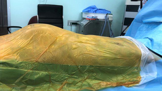 Karnındaki dev anevrizma, doktorlarını bile şoke etti: İnanamadım