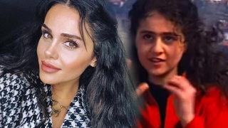 Günel Zeynalova estetiği abarttı! 'Ufak tefek işler'