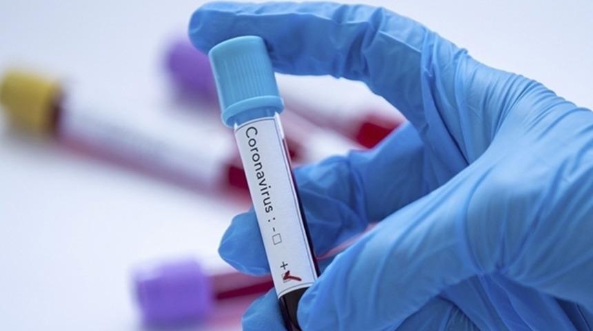 TFF, bir hakemin pozitif olduğunu duyurdu