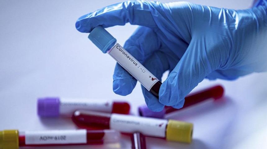 NBA'de 3 basketbolcunun Kovid-19 testi pozitif çıktı