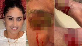 Asit saldırısına uğradı, artık sadece renkleri görebiliyor: Hayatım beş dakikada alt üst oldu