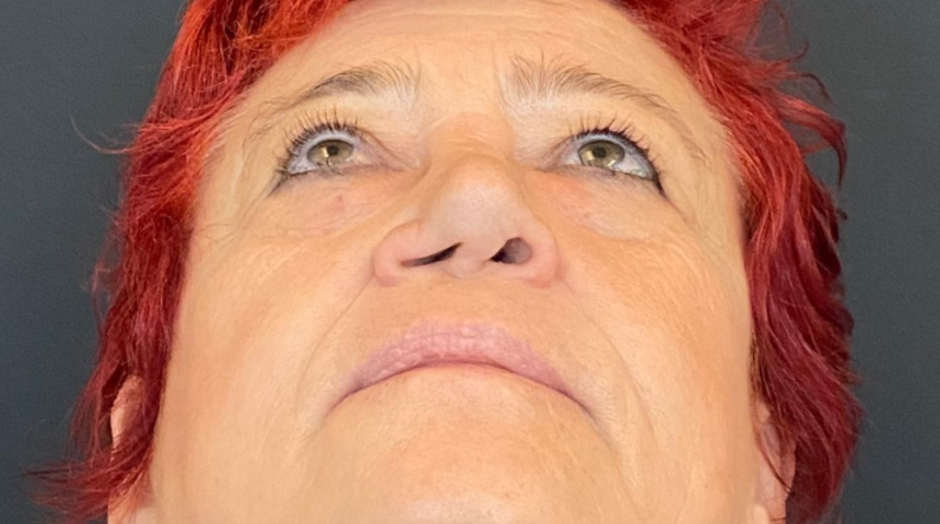 20 yılda iki defa çöktü! Yeni burnu iman tahtasından 