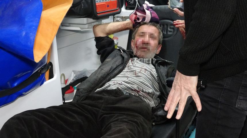 Bursa'da akılalmaz olay! Engelli kardeşini bıçaklayıp başında sigara içti