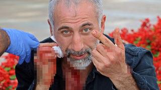 Polis üzerini aramak istedi, bir anda kendi boğazını kesti