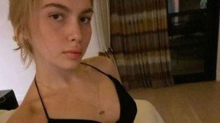 Aleyna Tilki'nin intihar yanıtından çok dudakları gündem oldu