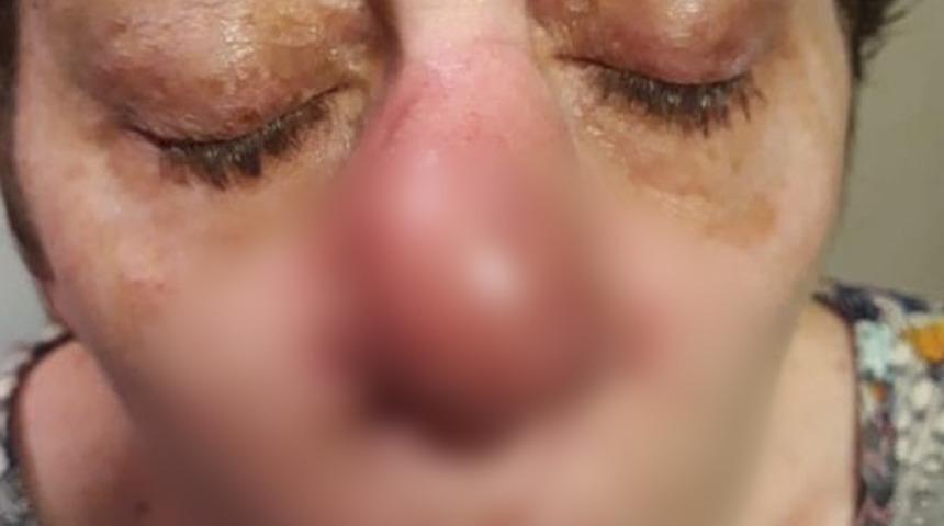 Firavun faresi cehennemi yaşattı! Komadan çıktığında organlarını kaybetti, doktorlar ''yaşamaz'' dedi