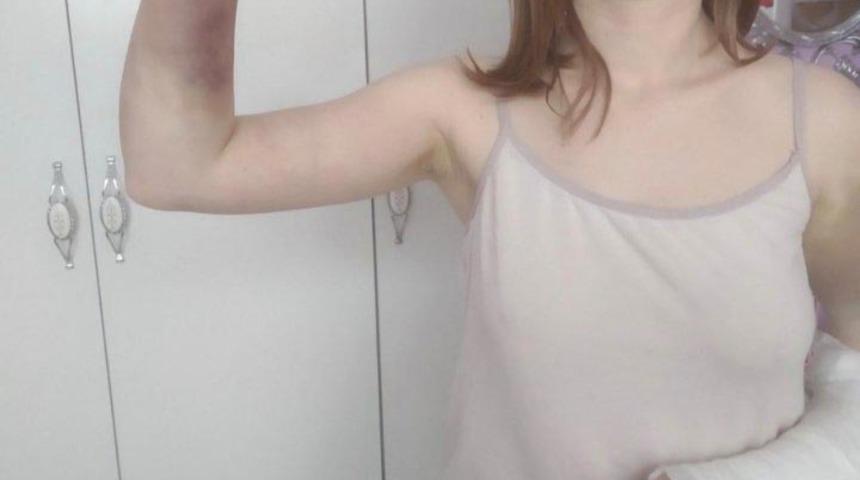 Her satırı korkunç! Kız arkadaşına beyzbol sopasıyla dehşeti yaşattı