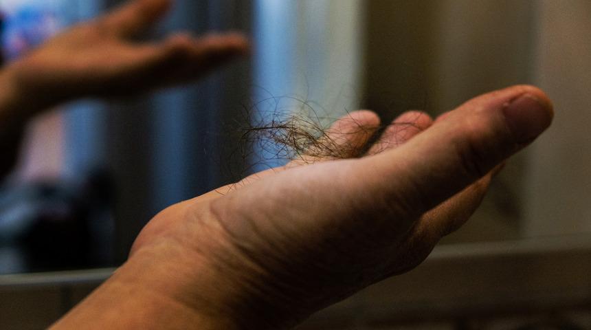 Koronavirüs sonrası saç dökülmesi için ne yapmalı?